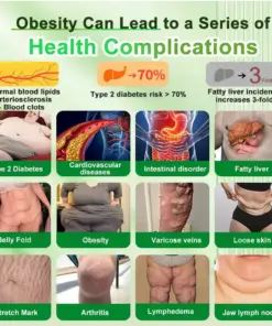 ๐๐ง๐จ๐๐จยฎ ๐๐๐ฃ-๐ญ ๐๐-๐ข๐ง-๐ ๐๐ฅ๐ข๐ฆ& ๐ฏ๐๐๐๐๐๐ฒ ๐ถ๐๐๐ ๐บ๐๐๐๐๐๐๐