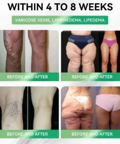 ๐๐ง๐จ๐๐จยฎ ๐๐๐ฃ-๐ญ ๐๐-๐ข๐ง-๐ ๐๐ฅ๐ข๐ฆ& ๐ฏ๐๐๐๐๐๐ฒ ๐ถ๐๐๐ ๐บ๐๐๐๐๐๐๐