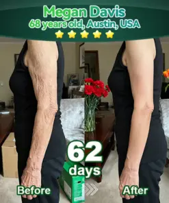 𝑩𝒏𝒐𝒅𝒐® 𝑆𝑡𝑒𝑚 𝐶𝑒𝑙𝑙 & 𝐶𝑜𝑙𝑙𝑎𝑔𝑒𝑛 𝑃𝑒𝑝𝑡𝑖𝑑𝑒 𝑂𝑟𝑎𝑙 𝐷𝑟𝑜𝑝𝑠