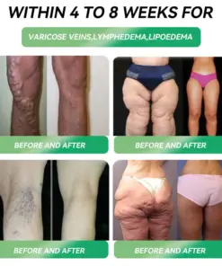 Bnodo® 𝐺𝐿𝑃-𝟏 𝐒𝐢𝐱 𝐢𝐧 𝑶𝐧𝐞 𝐇𝐞𝐚𝐥𝐭𝐡 𝐒𝐨𝐥𝐮𝐭𝐢𝐨𝐧 𝐎𝐫𝐚𝐥 𝐋𝐢𝐪𝐮𝐢d